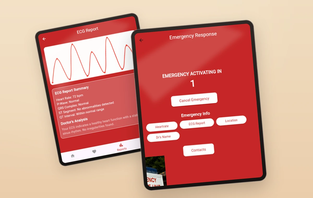 The ECG report beside the emergency response screen.