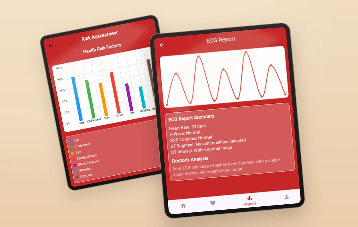 Cardio Shield on two tablets: the risk factor breakdown, and an ECG report.